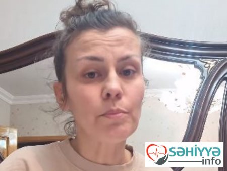 Bakıda bud əməliyyatına girən qadının burnunu kəsdilər – "TV-də reklam olunan “cərrahlar” məni şikəst ediblər"