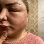 Kosmetoloq qadını pis günə qoyub Kosmetoloq qadını pis günə qoyub