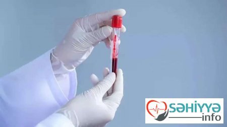 Bu qan qrupundan olanlara XƏBƏRDARLIQ