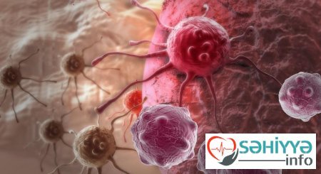 Xərçəng riskini artıran 6 peşə