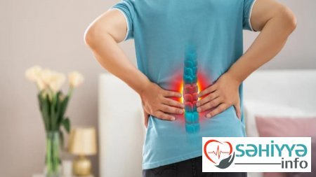 Bel ağrılarına ucuz çarə tapıldı
