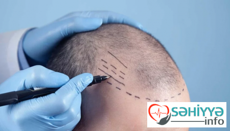 Ölüm hadisələri təkcə bizdə deyil Türkiyə klinikalarında da baş verir.