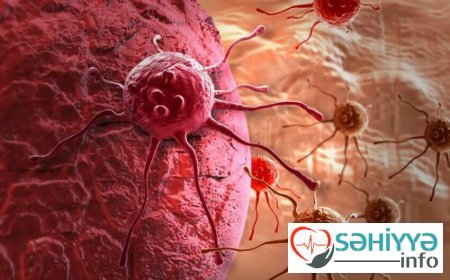 Beyin xərçənginin əlacı tapıldı