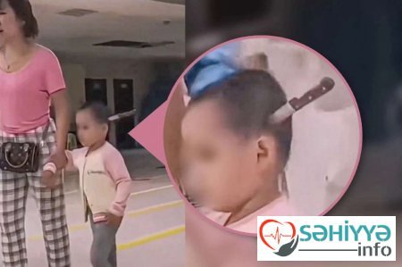 Azyaşlının başından 15 santimetrlik bıçaq çıxarıldı - FOTO