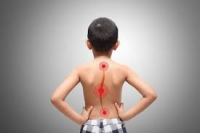 Uşaqlarda  skalioz. Səbəb və müalicəsi haqqında. Həkim məsləhəti