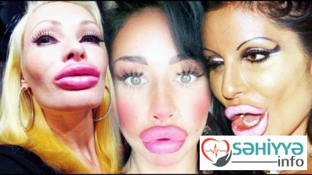 Plastik əməliyyat etdirən insanlar problemlərlə üzləşəcəklər