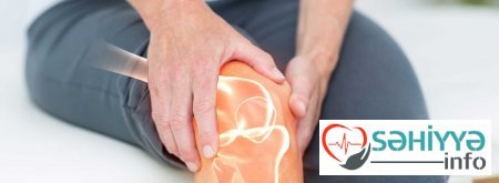 Kəskin diz ağrısı . Həkim məsləhəti