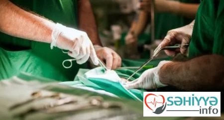 35 il mədəsində udduğu alışqanla gəzdi