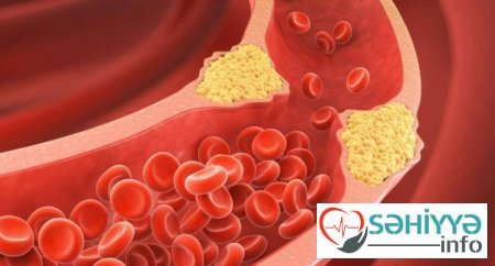 Bu meyvə xolestrini azaldır