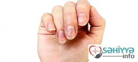 Sink çatışmazlığı nələrə səbəb olur? - problemi aradan qaldırmağın yolları