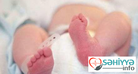 Bakıdan dəfn üçün aparılan körpə yolda ayıldı