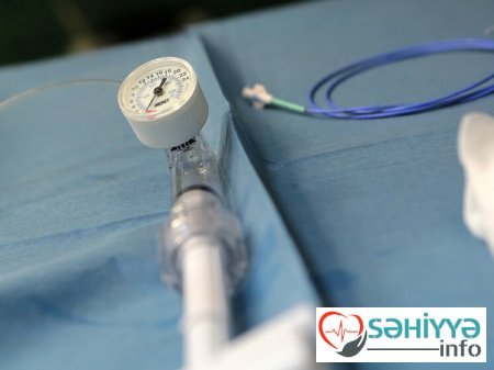 Arıqlamağın ağlasığmaz qiyməti: 