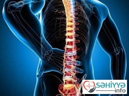 Onurğa xəstəlikləri barədə. Həkim məsləhəti