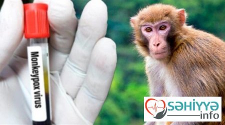 Taylanddan qayıdan turistlərdə meymunçiçəyi aşkarlandı