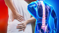 Travmadan olan onurğa ağrıları barədə. Həkim məsləhəti