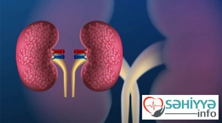 Böyrək sağlamlığı üçün 7 qızıl qayda: Bu səhvlərə yol verməyin!