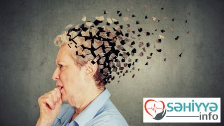 Alzheimer xəstəliyi barədə. Həkim məsləhəti