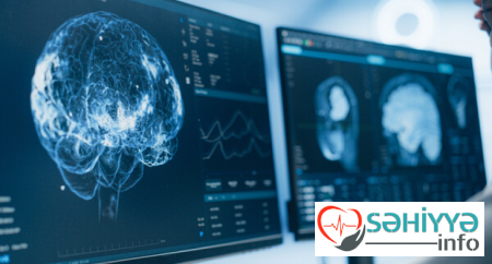 Bu məşqlər beyin qocalmasını yavaşladır