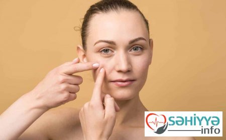 Sızanaqlar bu xəstəliyin göstəricisi ola bilər