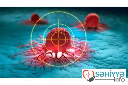 Xərçəngin müalicəsində İNQİLAB- 90 faiz dəqiqliklə test edilir