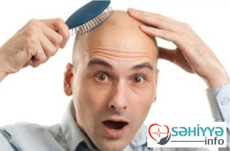 Həkimlərdən maraqlı açıqlama: Keçəl kişilər daha enerjili və...