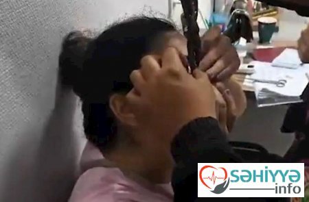 Göz qapağı geyiminin zəncirbəndinə ilişən qadına köməklik göstərilib.VİDEO