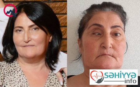 Liman klinikası təzminat ödəyəcək