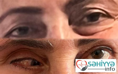 Liman klinikası təzminat ödəyəcək